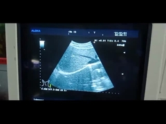 پروب اولتراسوند Aloka UST-9130 آرایه محدب مبدل اولتراسوند UST-9130