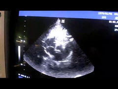 پروب مبدل اولتراسوند آرایه فازی Mindray 2P2 برای قلب / اطفال