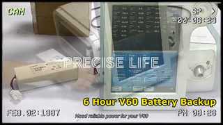 باتری ونتیلاتور Respironics V60 6 ساعته